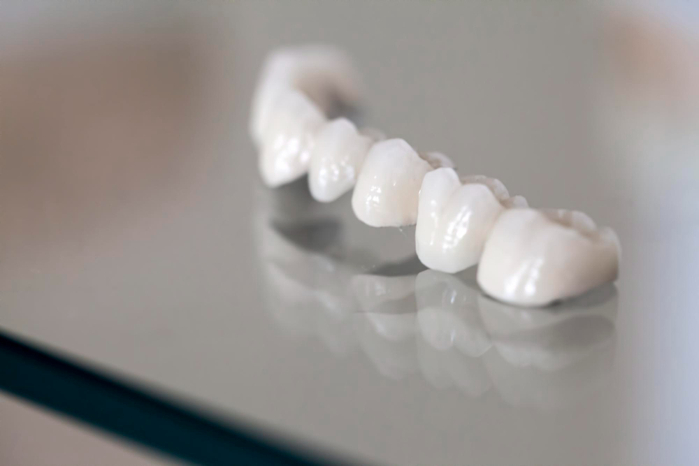 Porcelain Crowns in Torrance