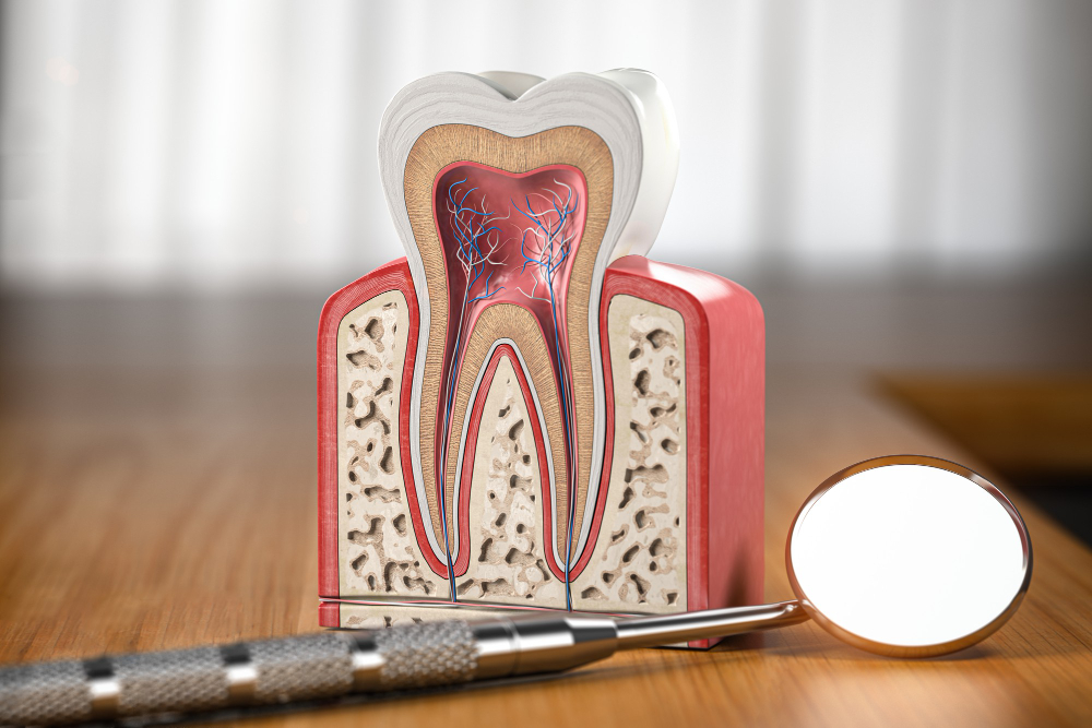 Root Canals in Torrance
