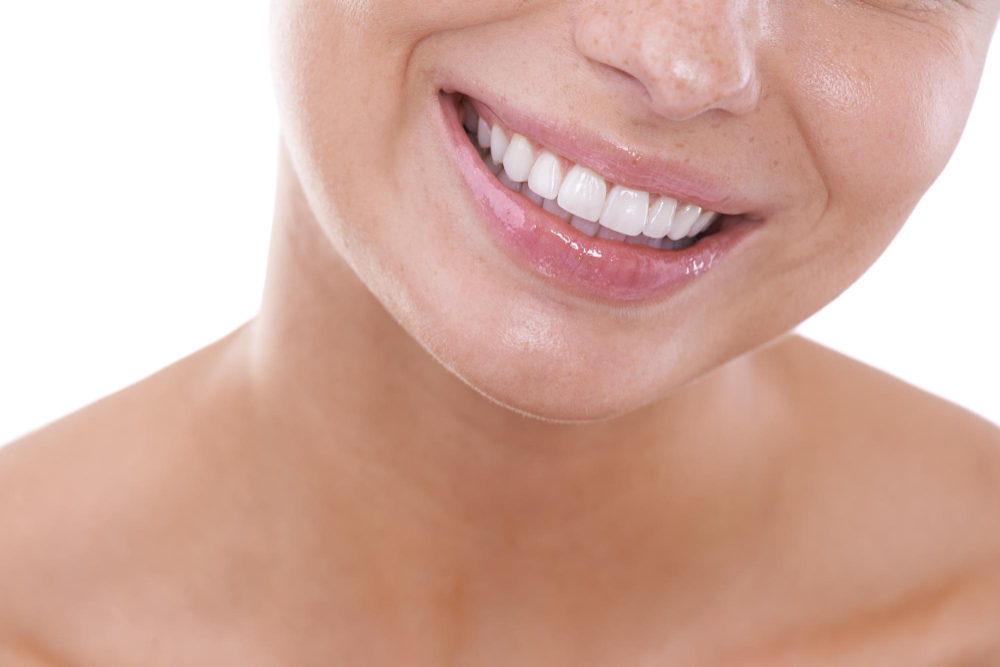 Sealants in Torrance
