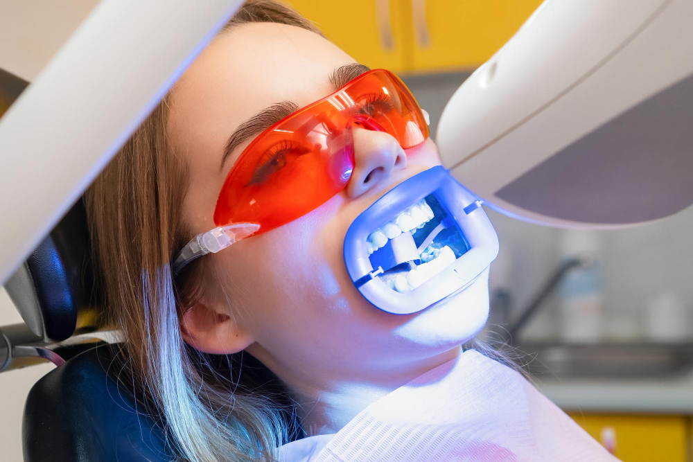 Teeth Whitening Torrance, CA